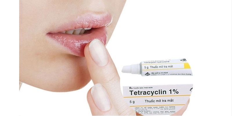 Thuốc Tetracyclin bôi ngoài da sau phun môi
