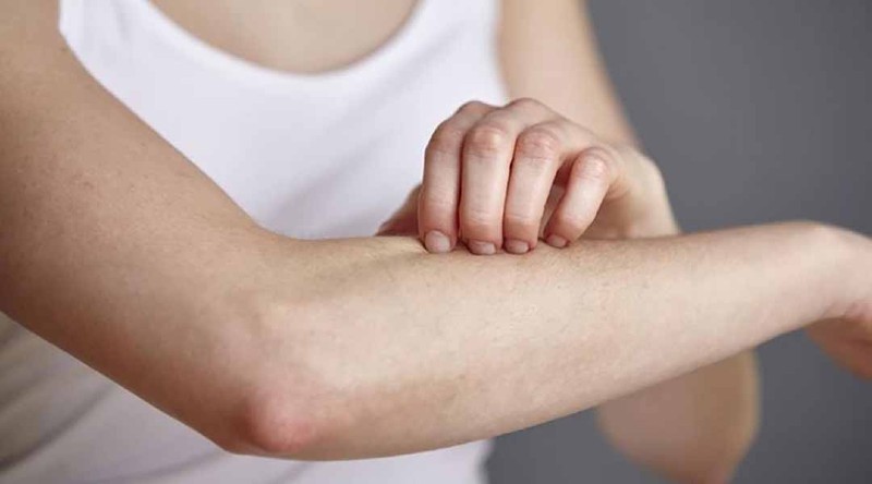 Sử dụng Tetracyclin sai cách có thể khiến cho làn da của bạn bị ngứa rát