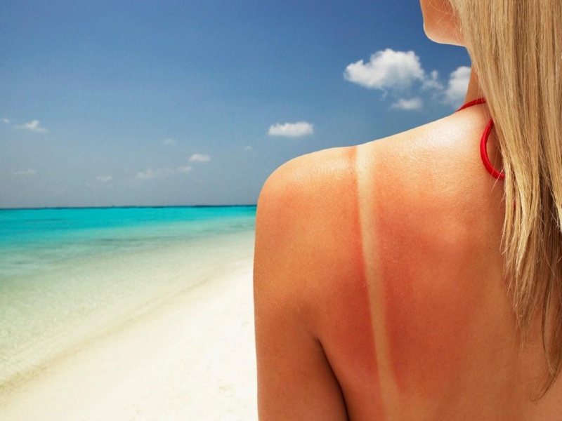 Kem chống nắng có khả năng giảm nguy cơ bị cháy nắng hiệu quả nhờ “màng chắn” sinh học đặc biệt